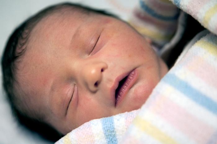 Скоринка на голові у новонародженого: чи варто хвилюватися і як її прибрати?